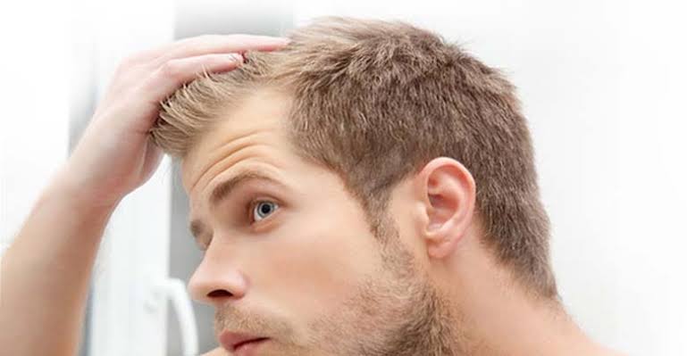 Hair Loss in Men - Blog - Male Hair Transplant